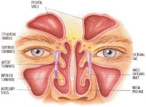 sinus infection medicine
